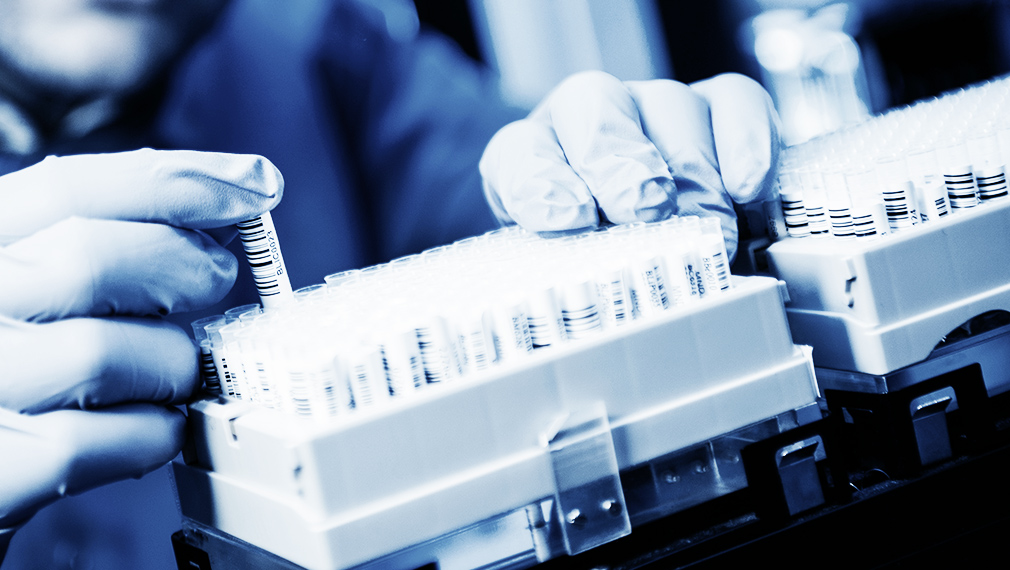 Raw material advantage